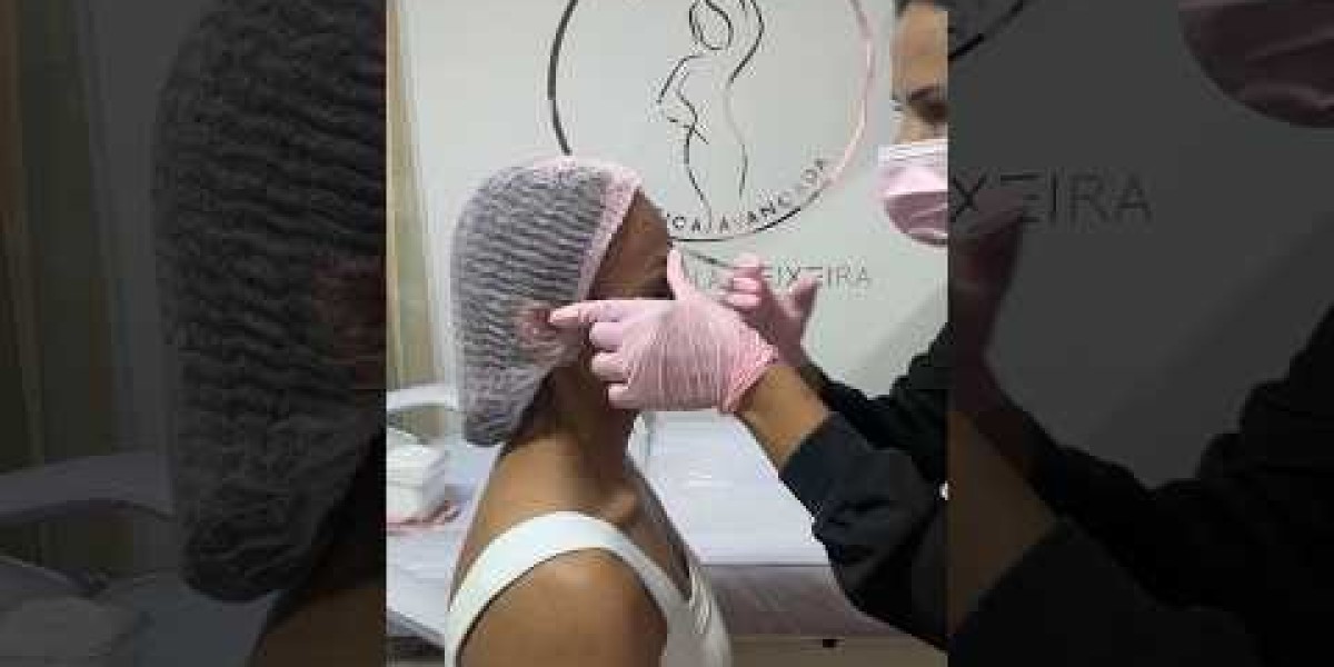 Armonización facial con ácido hialurónico